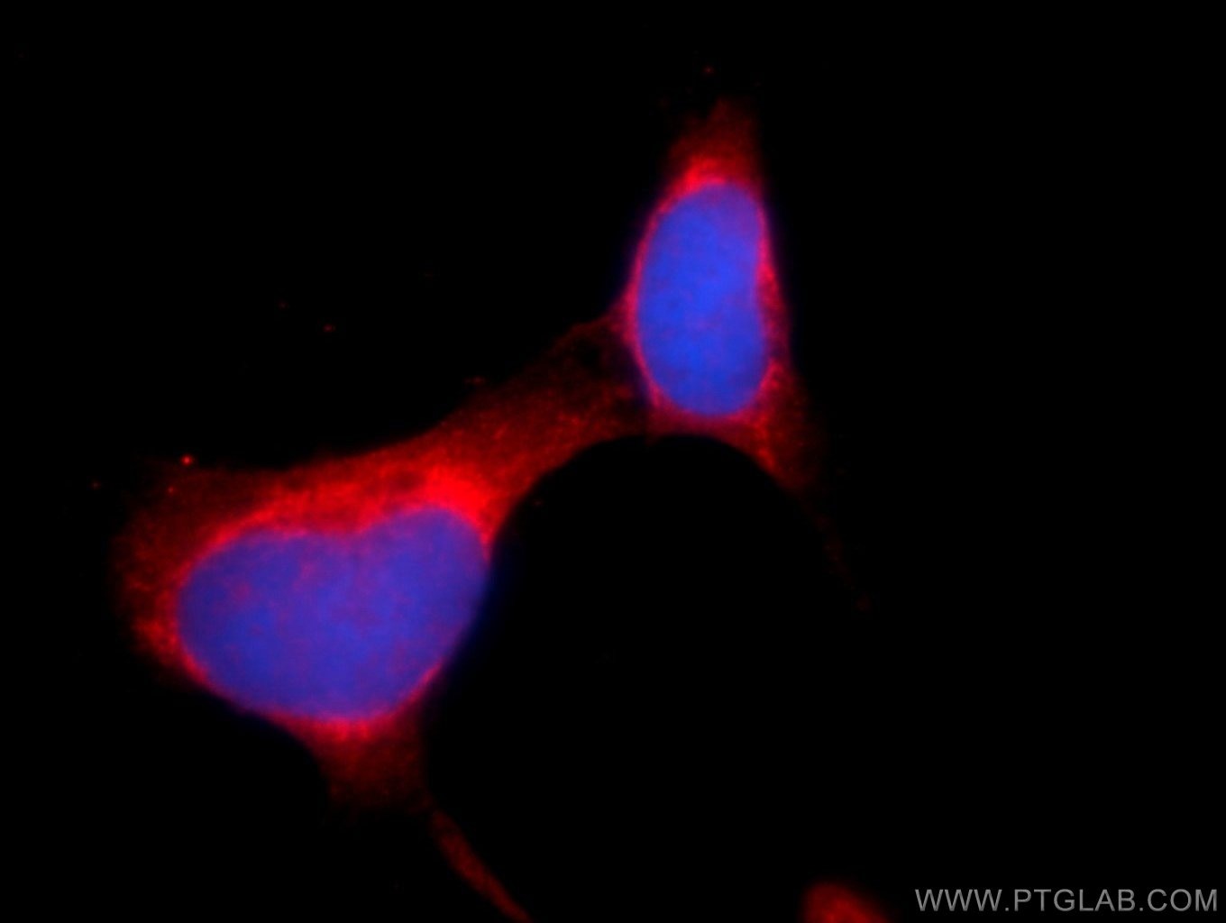 IF Staining of HEK-293 using 25203-1-AP