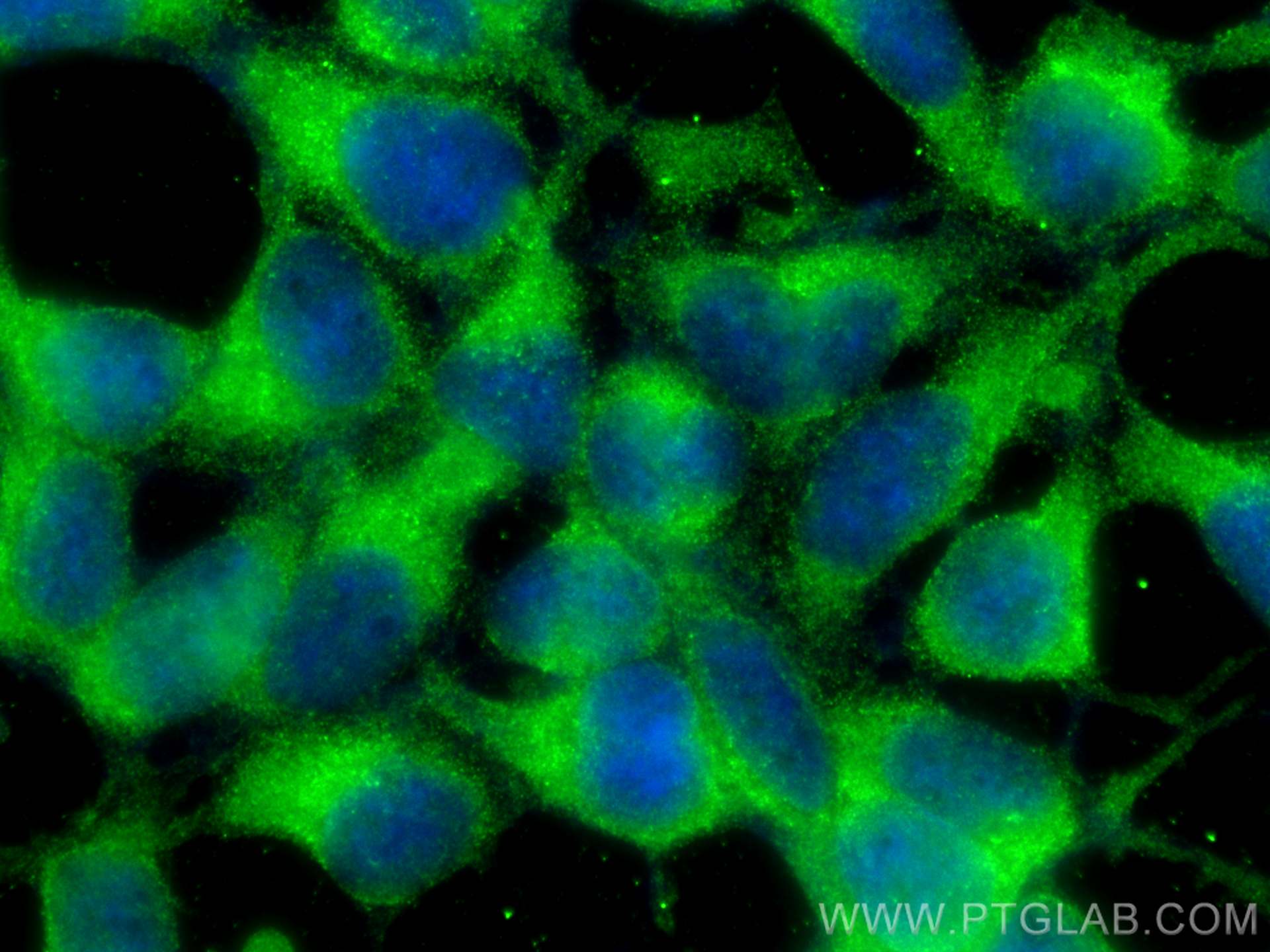 Immunofluorescence (IF) / fluorescent staining of HEK-293 cells using DDHD2 Polyclonal antibody (25203-1-AP)