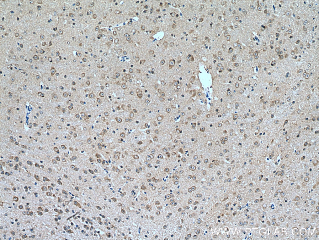 Immunohistochemistry (IHC) staining of mouse brain tissue using DDHD2 Polyclonal antibody (25203-1-AP)