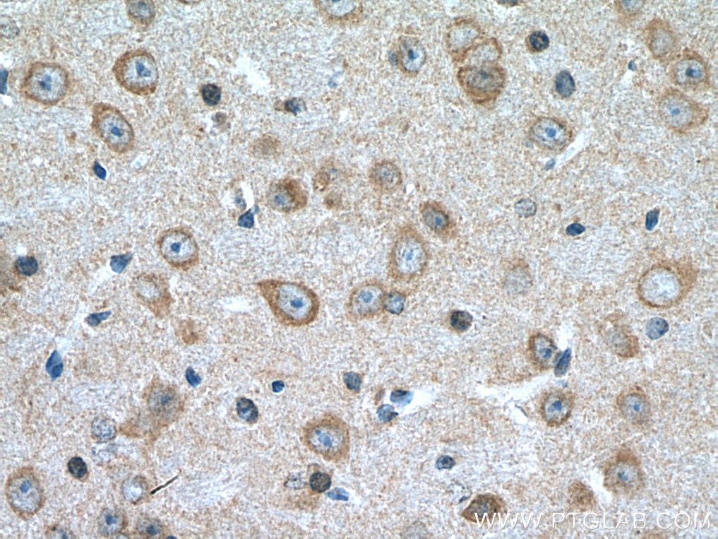 Immunohistochemistry (IHC) staining of mouse brain tissue using DDHD2 Polyclonal antibody (25203-1-AP)
