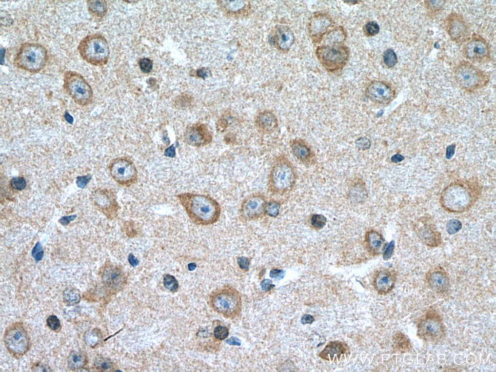 Immunohistochemistry (IHC) staining of mouse brain tissue using DDHD2 Polyclonal antibody (25203-1-AP)