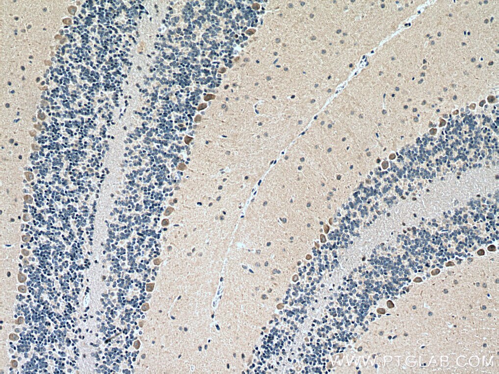 Immunohistochemistry (IHC) staining of mouse cerebellum tissue using DDHD2 Polyclonal antibody (25203-1-AP)