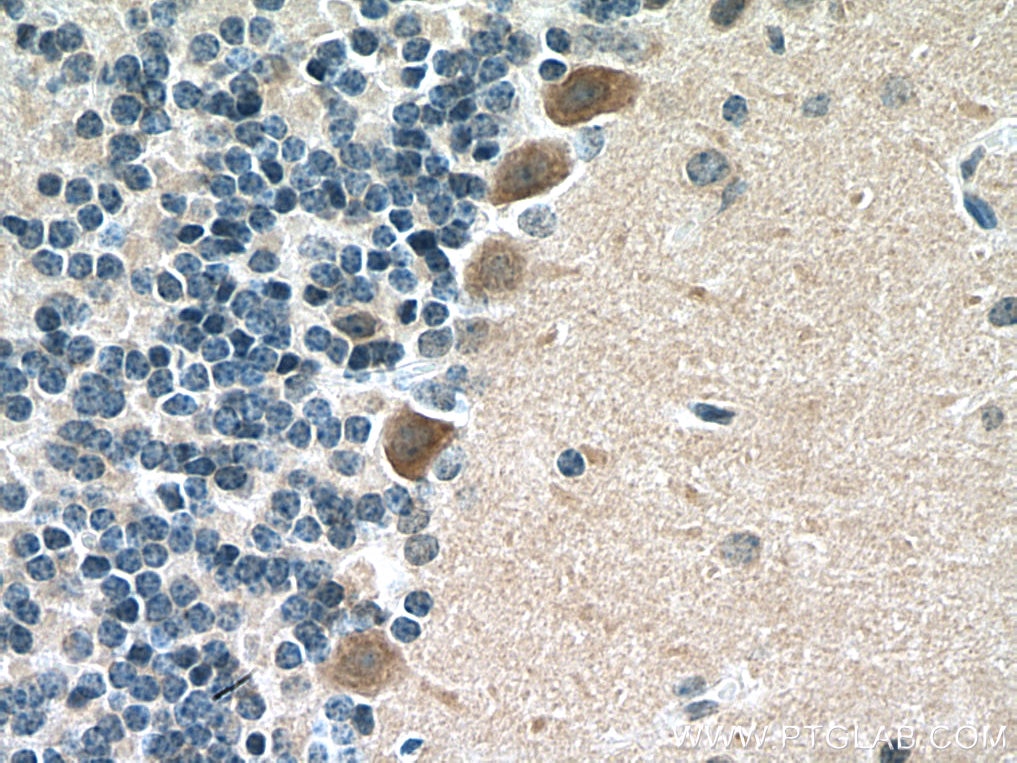 Immunohistochemistry (IHC) staining of mouse cerebellum tissue using DDHD2 Polyclonal antibody (25203-1-AP)