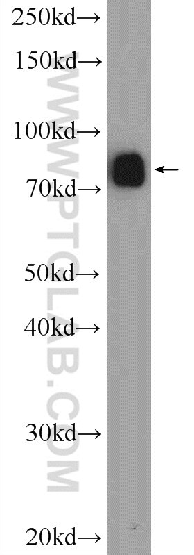 Western Blot (WB) analysis of rat brain tissue using DDHD2 Polyclonal antibody (25203-1-AP)