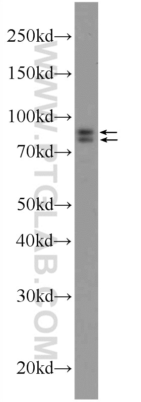 Western Blot (WB) analysis of mouse lung tissue using DDHD2 Polyclonal antibody (25203-1-AP)