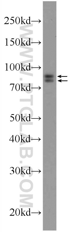 WB analysis of mouse lung using 25203-1-AP