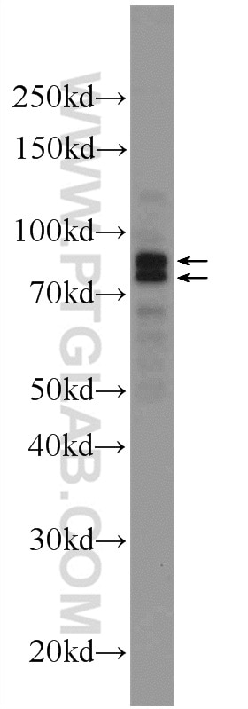 Western Blot (WB) analysis of mouse testis tissue using DDHD2 Polyclonal antibody (25203-1-AP)