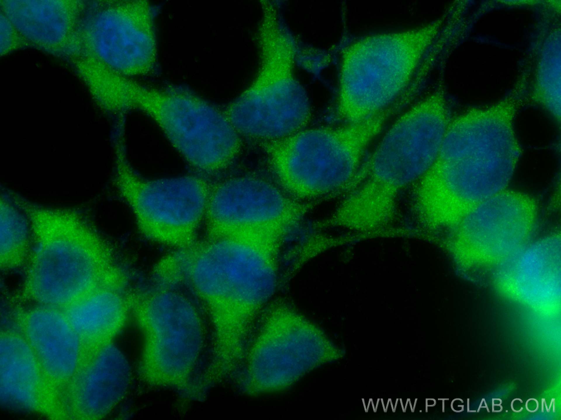 Immunofluorescence (IF) / fluorescent staining of HEK-293 cells using CoraLite® Plus 488-conjugated DDHD2 Polyclonal ant (CL488-25203)