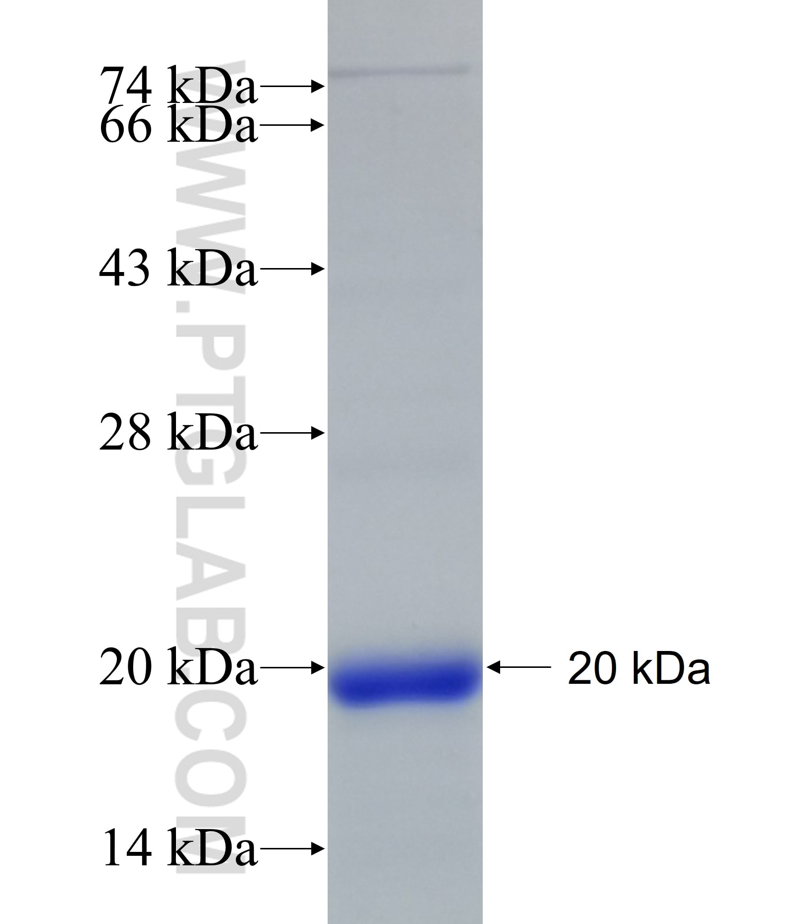 DDHD2 fusion protein Ag18391 SDS-PAGE