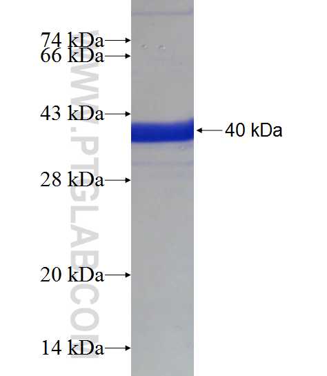 DDHD2 fusion protein Ag18373 SDS-PAGE