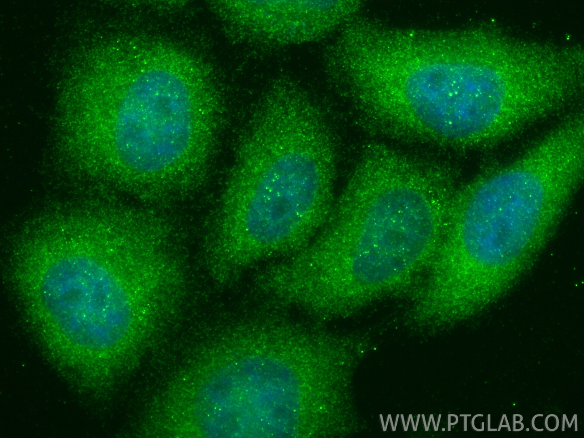 Immunofluorescence (IF) / fluorescent staining of HepG2 cells using DDI2 Polyclonal antibody (25377-1-AP)