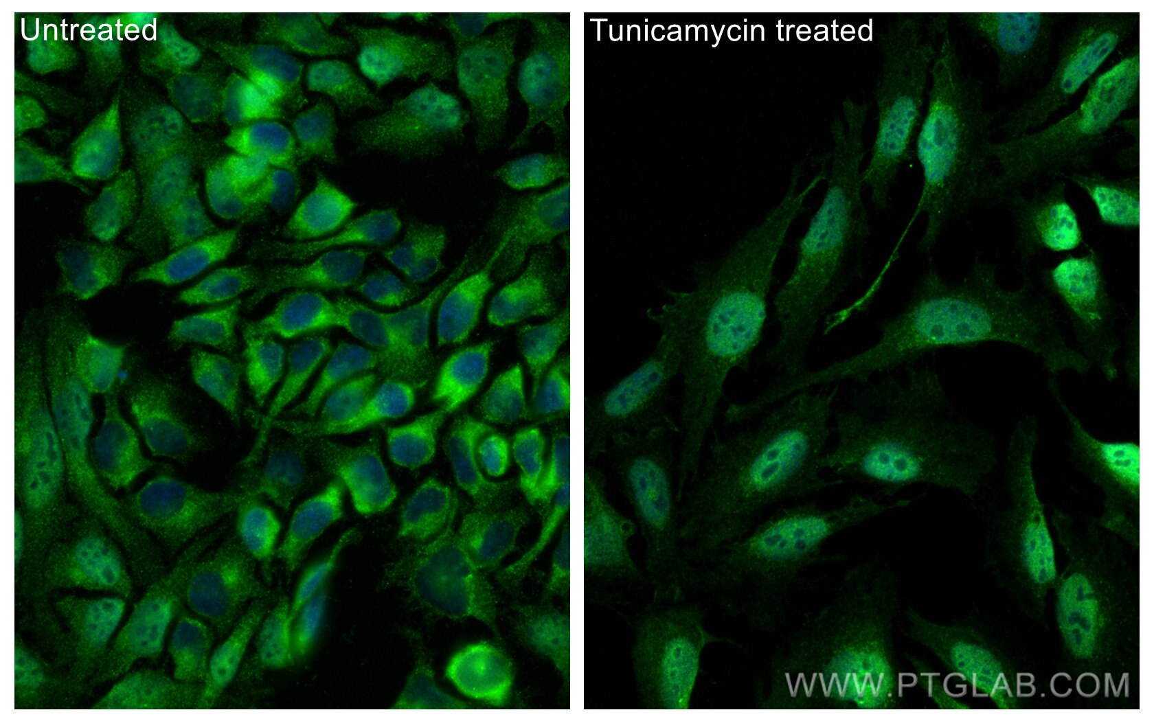 Immunofluorescence (IF) / fluorescent staining of HeLa cells using CHOP; GADD153 Polyclonal antibody (15204-1-AP)