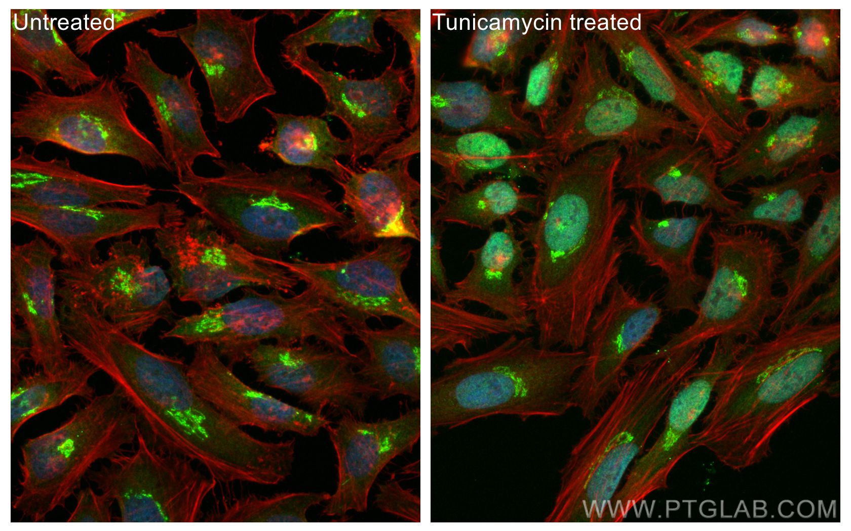 Immunofluorescence (IF) / fluorescent staining of HeLa cells using CHOP; GADD153 Polyclonal antibody (15204-1-AP)