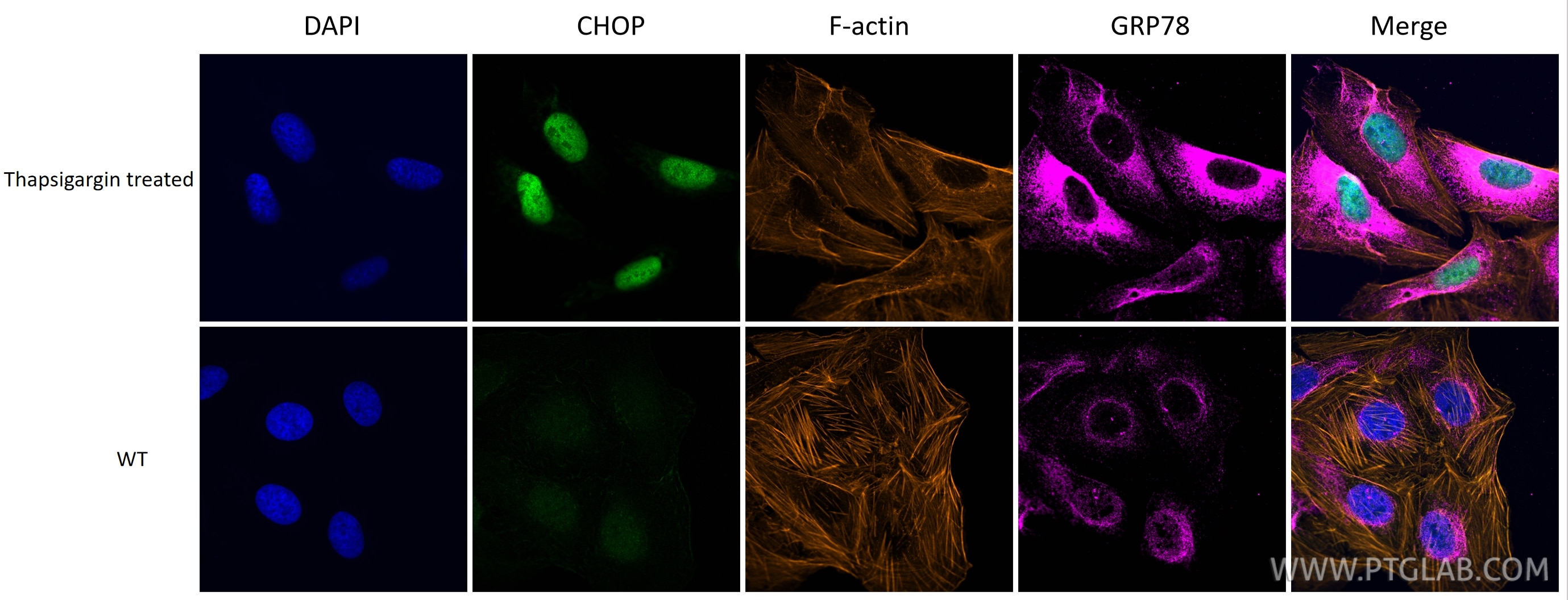 Immunofluorescence (IF) / fluorescent staining of U2OS cells using CHOP/GADD153 Polyclonal antibody (15204-1-AP)