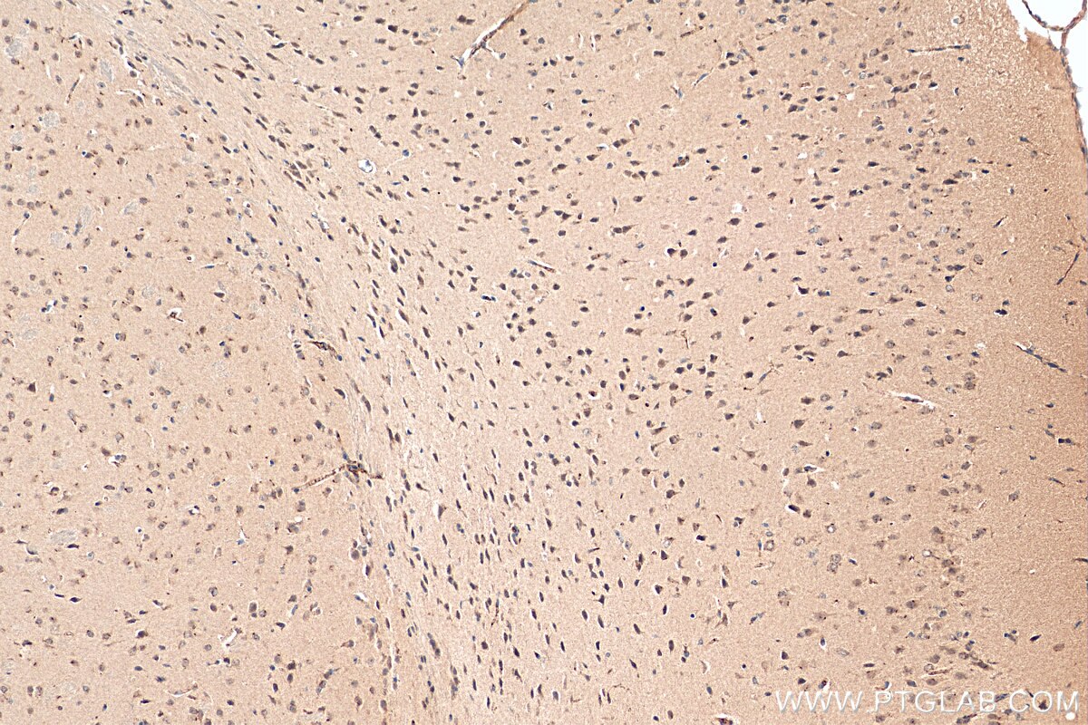 Immunohistochemistry (IHC) staining of mouse brain tissue using CHOP; GADD153 Polyclonal antibody (15204-1-AP)
