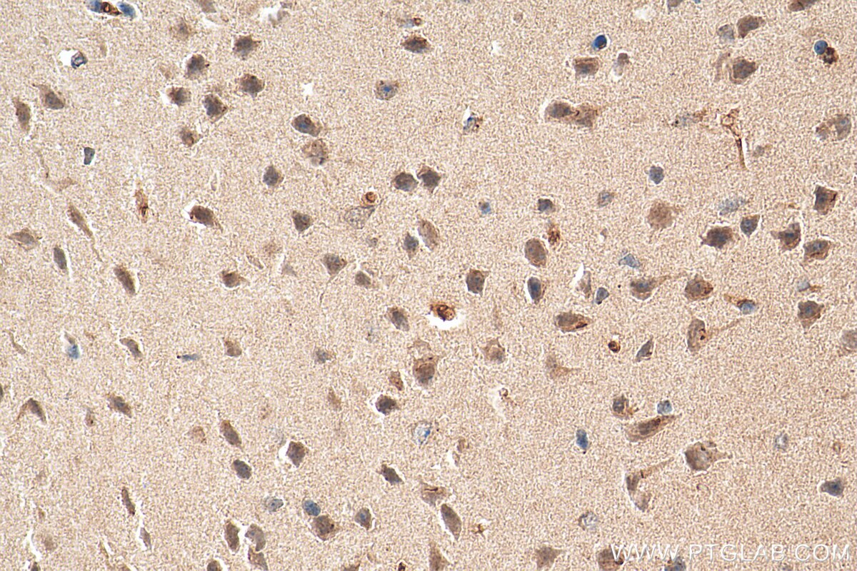 Immunohistochemistry (IHC) staining of mouse brain tissue using CHOP; GADD153 Polyclonal antibody (15204-1-AP)