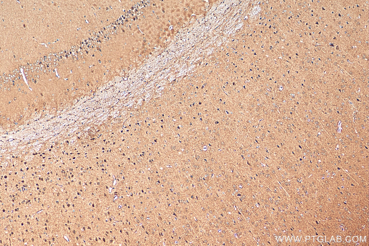 Immunohistochemistry (IHC) staining of mouse brain tissue using CHOP; GADD153 Polyclonal antibody (15204-1-AP)