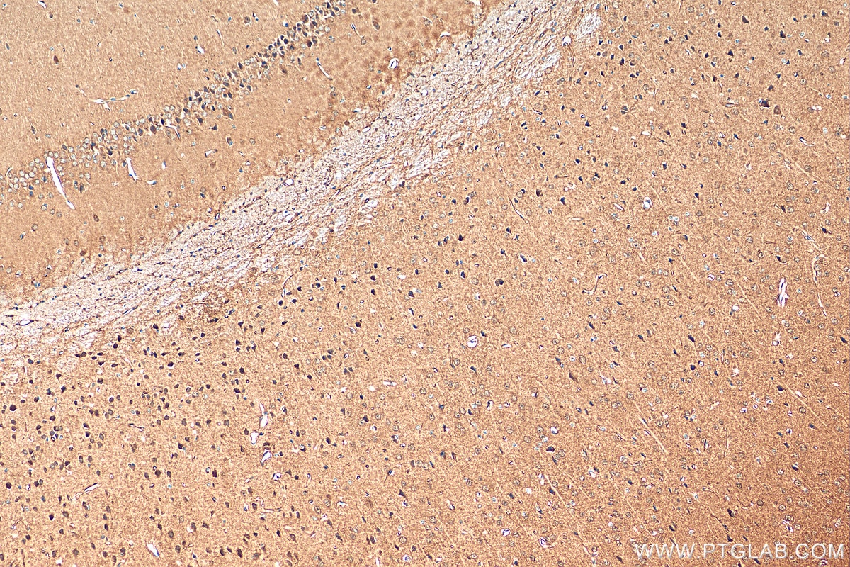 IHC staining of mouse brain using 15204-1-AP