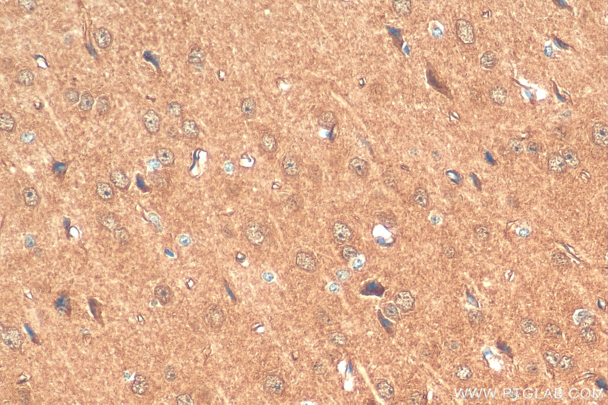 Immunohistochemistry (IHC) staining of mouse brain tissue using CHOP; GADD153 Polyclonal antibody (15204-1-AP)