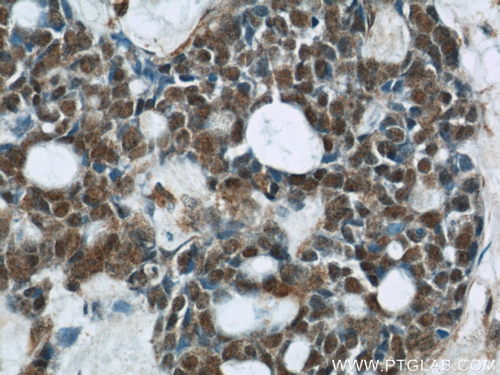 CHOP; GADD153 Polyclonal antibody