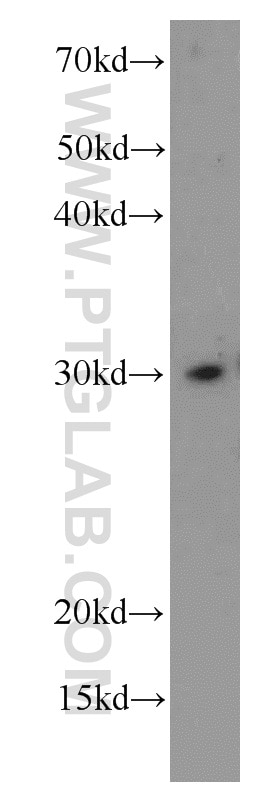 Western Blot (WB) analysis of MCF-7 cells using CHOP; GADD153 Polyclonal antibody (15204-1-AP)
