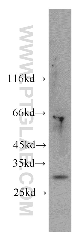 CHOP; GADD153 Polyclonal antibody