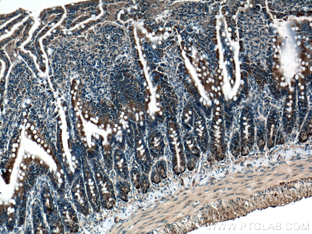 Immunohistochemistry (IHC) staining of rat small intestine tissue using DDOST Polyclonal antibody (14916-1-AP)