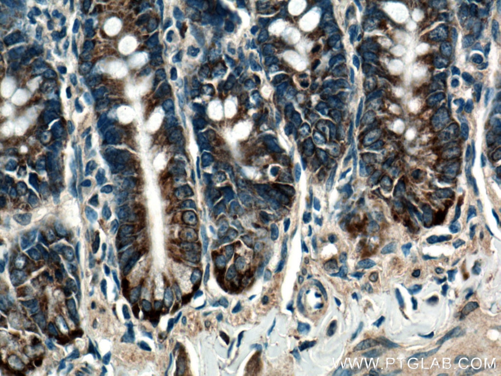 Immunohistochemistry (IHC) staining of rat small intestine tissue using DDOST Polyclonal antibody (14916-1-AP)