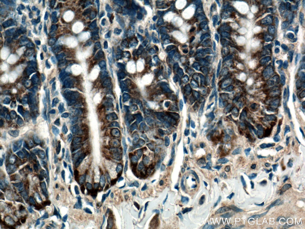 IHC staining of rat small intestine using 14916-1-AP