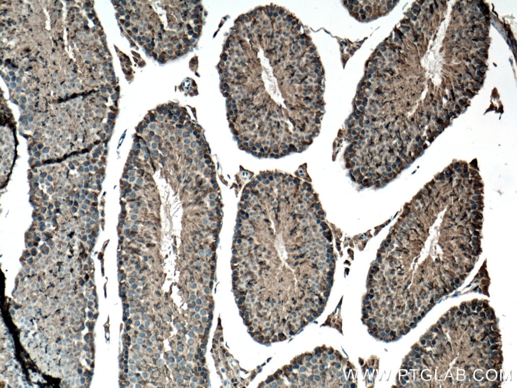 Immunohistochemistry (IHC) staining of mouse testis tissue using DDOST Polyclonal antibody (14916-1-AP)