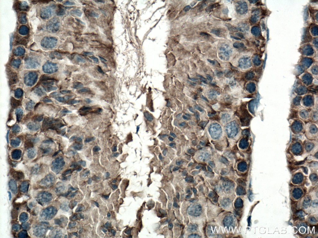 Immunohistochemistry (IHC) staining of mouse testis tissue using DDOST Polyclonal antibody (14916-1-AP)