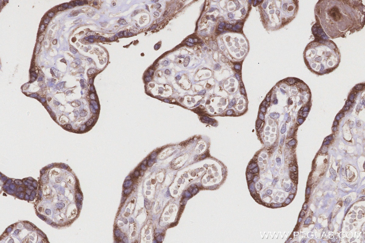 IHC staining of human placenta using 14916-1-AP Immunohistochemistry (IHC) staining of human placenta tissue using DDOST Polyclonal antibody (14916-1-AP)