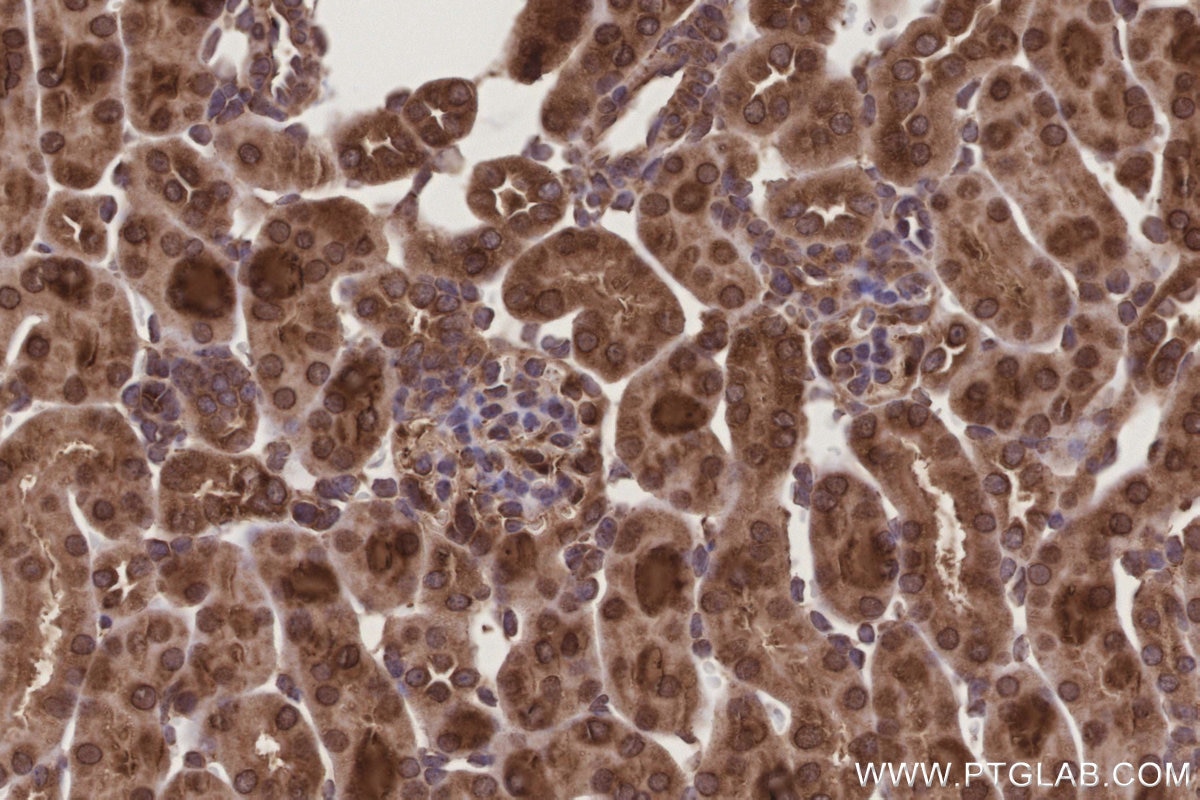 IHC staining of mouse kidney using 14916-1-AP Immunohistochemistry (IHC) staining of mouse kidney tissue using DDOST Polyclonal antibody (14916-1-AP)
