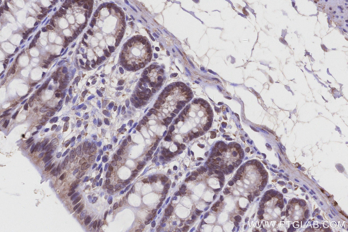 IHC staining of rat colon using 14916-1-AP Immunohistochemistry (IHC) staining of rat colon tissue using DDOST Polyclonal antibody (14916-1-AP)