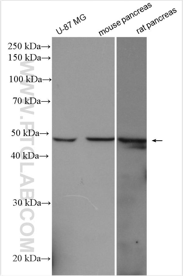 Western Blot (WB) analysis of various lysates using DDOST Polyclonal antibody (14916-1-AP)