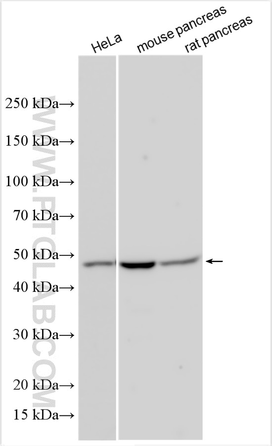 Western Blot (WB) analysis of various lysates using DDOST Polyclonal antibody (14916-1-AP)