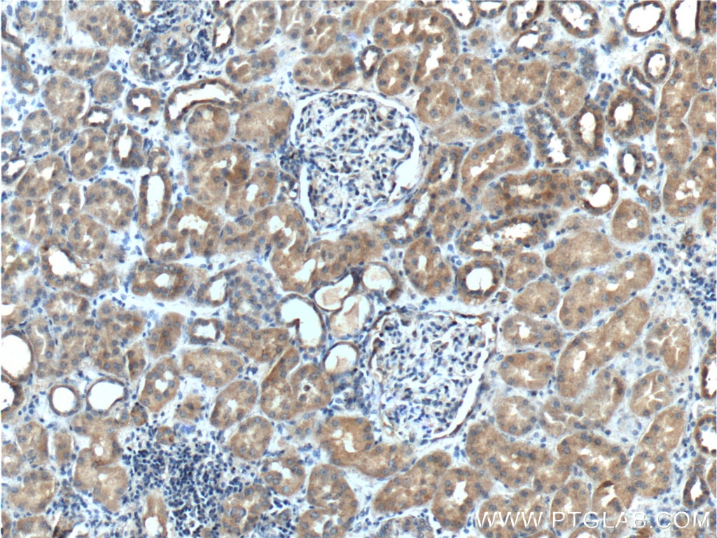 Immunohistochemistry (IHC) staining of human kidney tissue using DDR1 Polyclonal antibody (10536-1-AP)