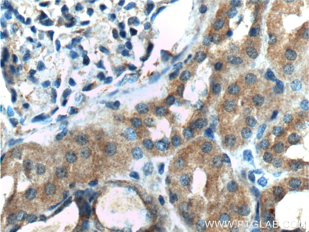 Immunohistochemistry (IHC) staining of human kidney tissue using DDR1 Polyclonal antibody (10536-1-AP)