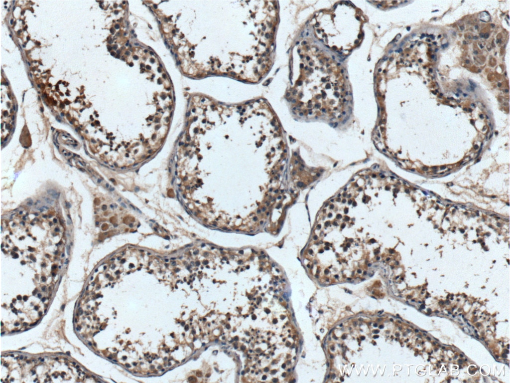 Immunohistochemistry (IHC) staining of human testis tissue using DDR1 Polyclonal antibody (10536-1-AP)