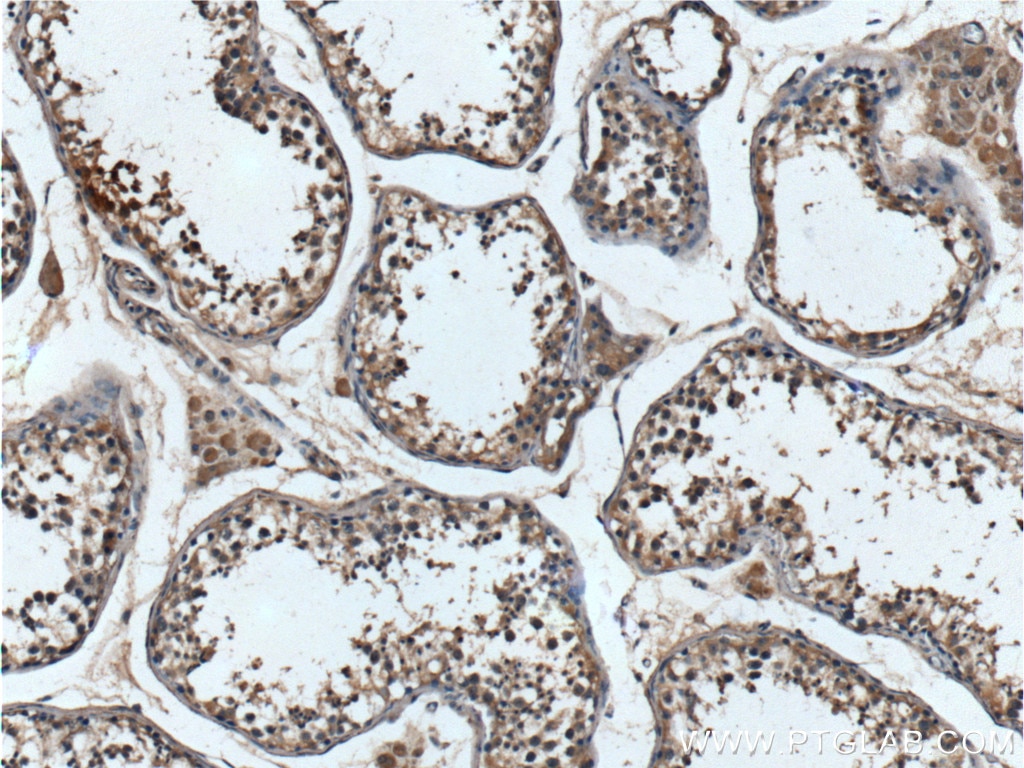 IHC staining of human testis using 10536-1-AP