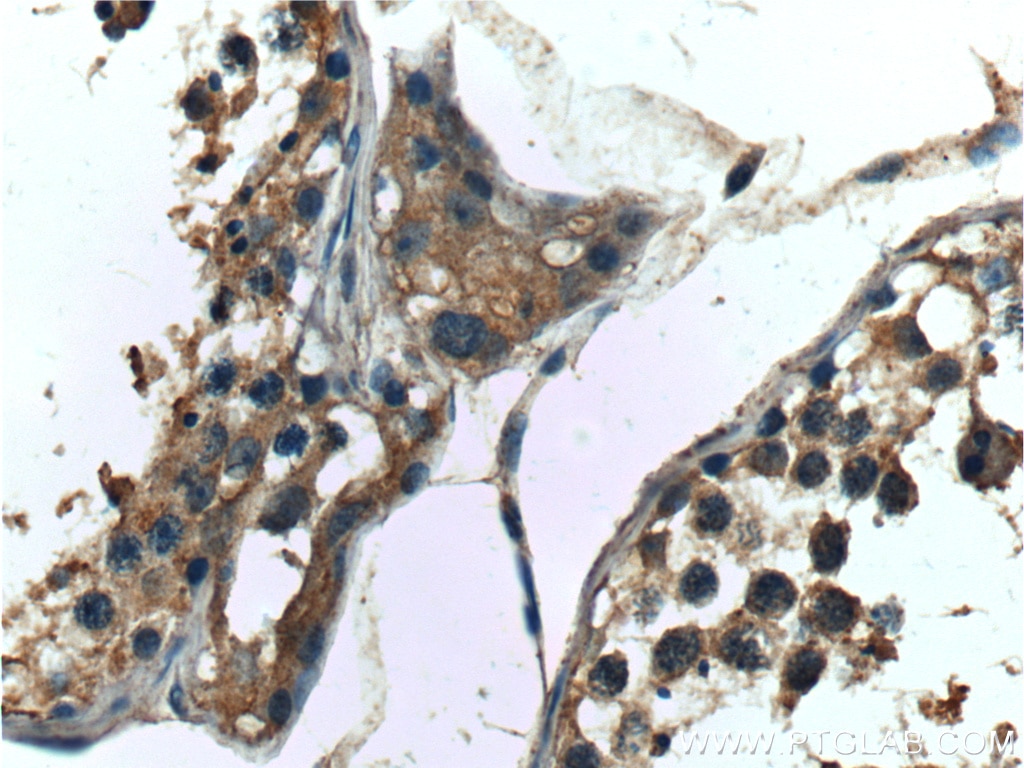 IHC staining of human testis using 10536-1-AP