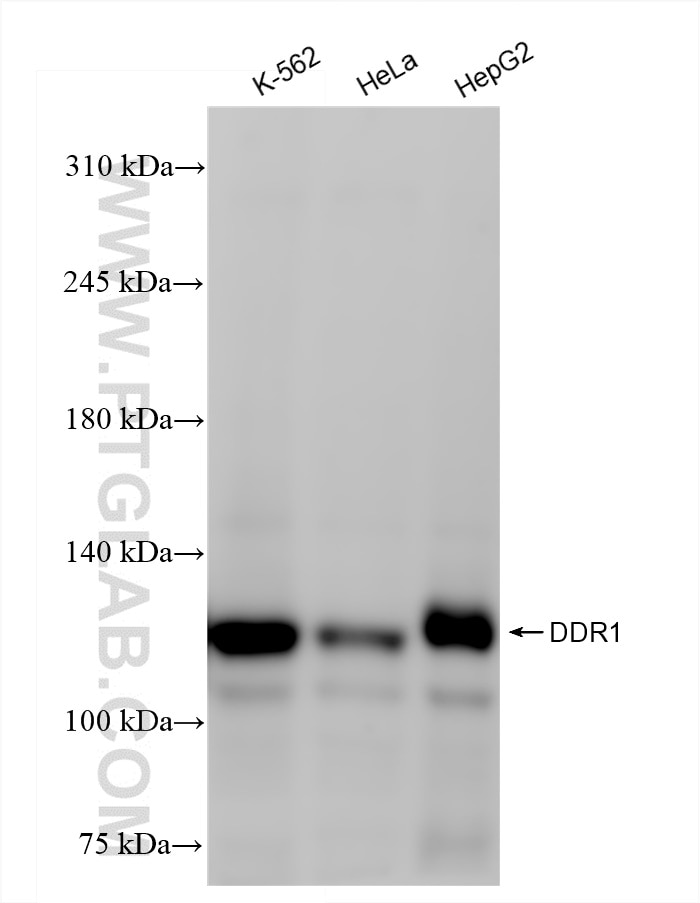 DDR1