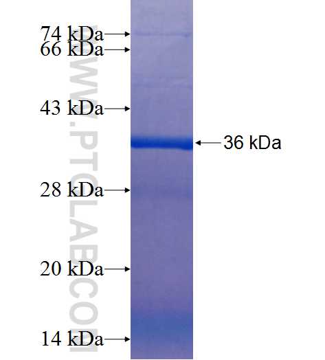 DDR1 fusion protein Ag25768 SDS-PAGE