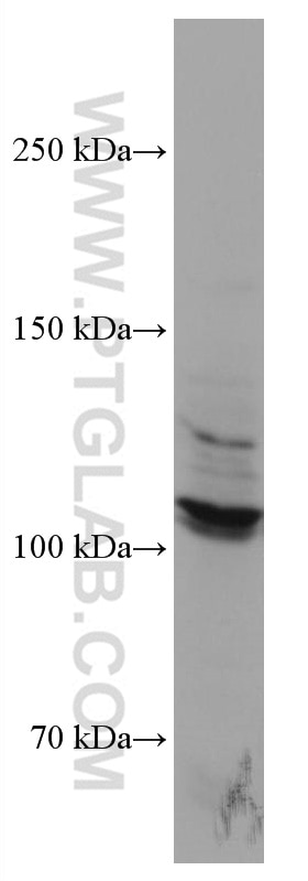 Western Blot (WB) analysis of HEK-293 cells using DDR2 Monoclonal antibody (67126-1-Ig)