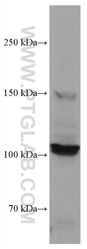 Western Blot (WB) analysis of HepG2 cells using DDR2 Monoclonal antibody (67126-1-Ig)