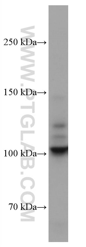 Western Blot (WB) analysis of HeLa cells using DDR2 Monoclonal antibody (67126-1-Ig)