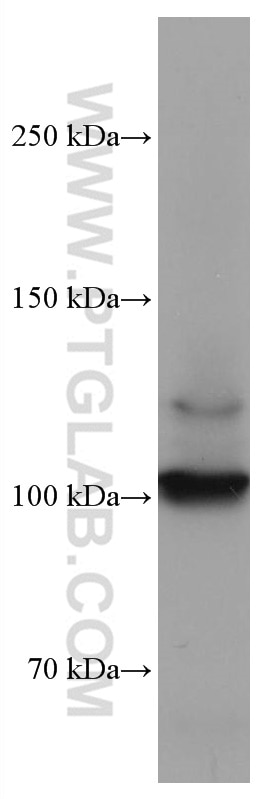 Western Blot (WB) analysis of Jurkat cells using DDR2 Monoclonal antibody (67126-1-Ig)