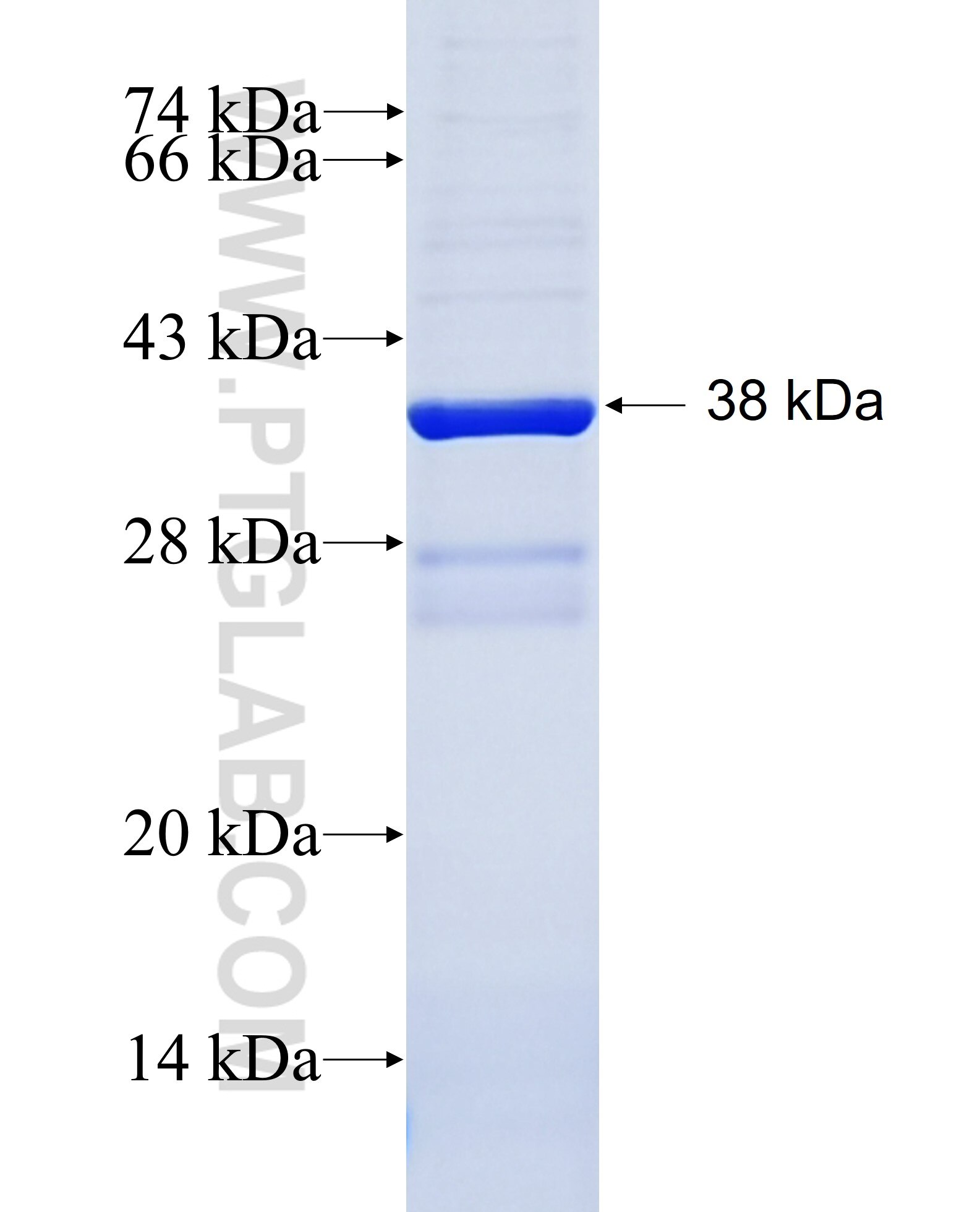 DDR2 fusion protein Ag28183 SDS-PAGE