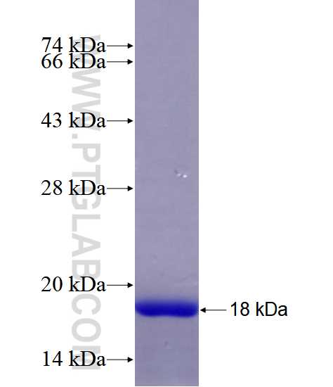 DDR2 fusion protein Ag28340 SDS-PAGE