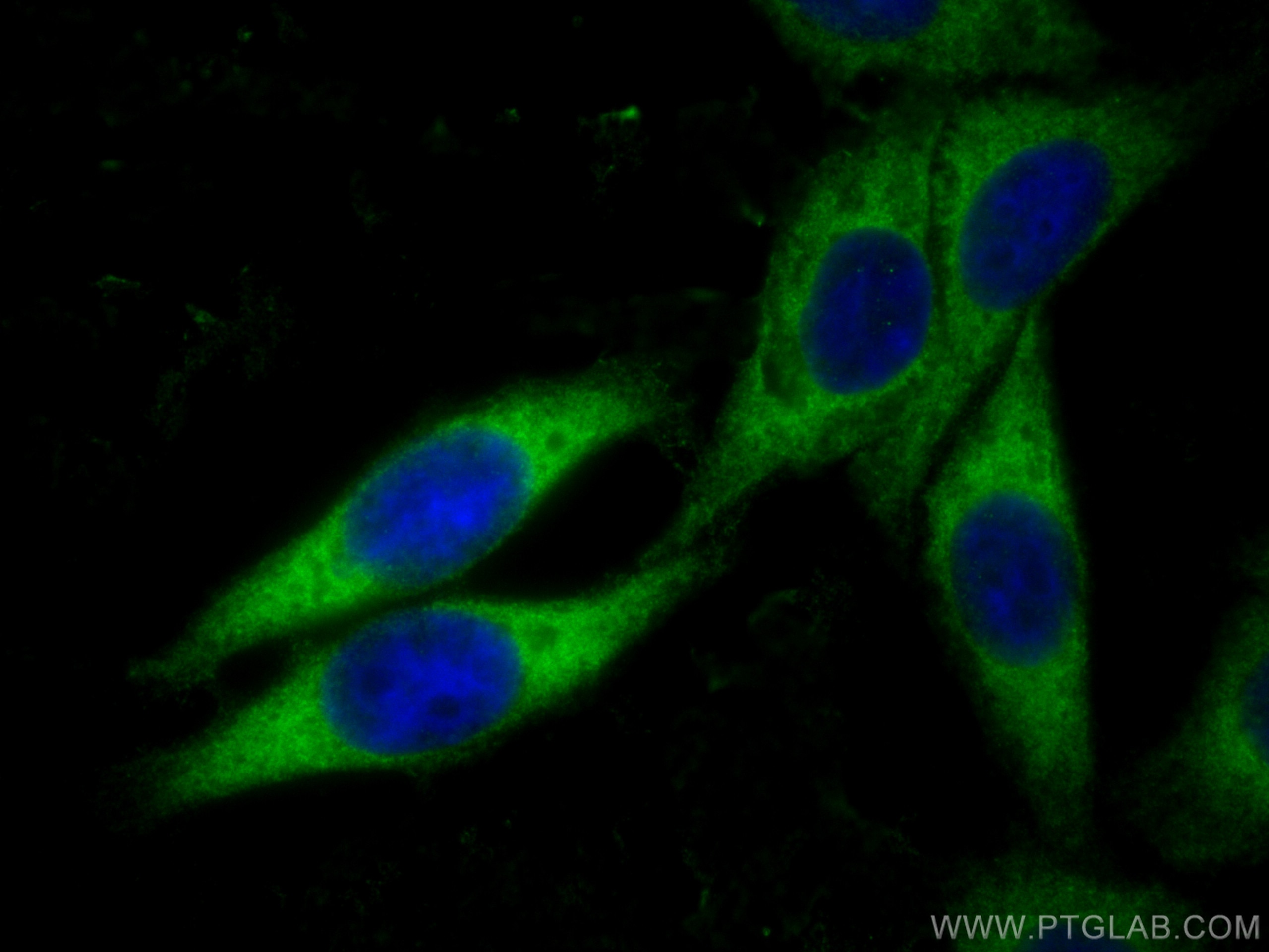 Immunofluorescence (IF) / fluorescent staining of HepG2 cells using DDRGK1 Polyclonal antibody (21445-1-AP)